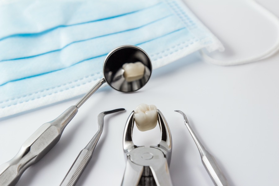 Tooth extraction Isle of Man