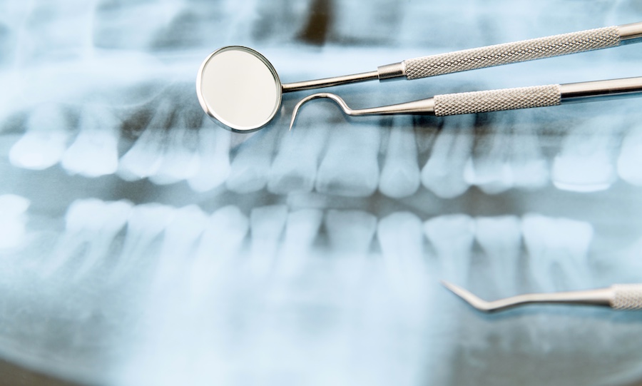Isle of Man Dental x-ray