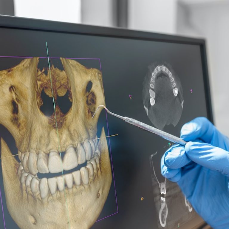 CBCT