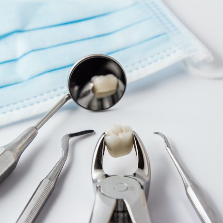 Tooth extraction Isle of Man