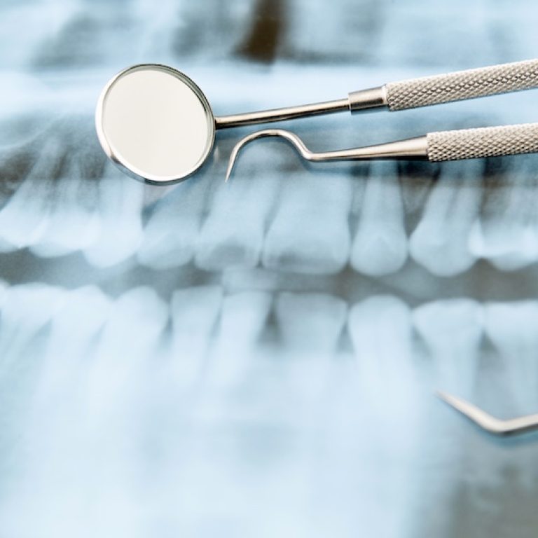 Isle of Man Dental x-ray