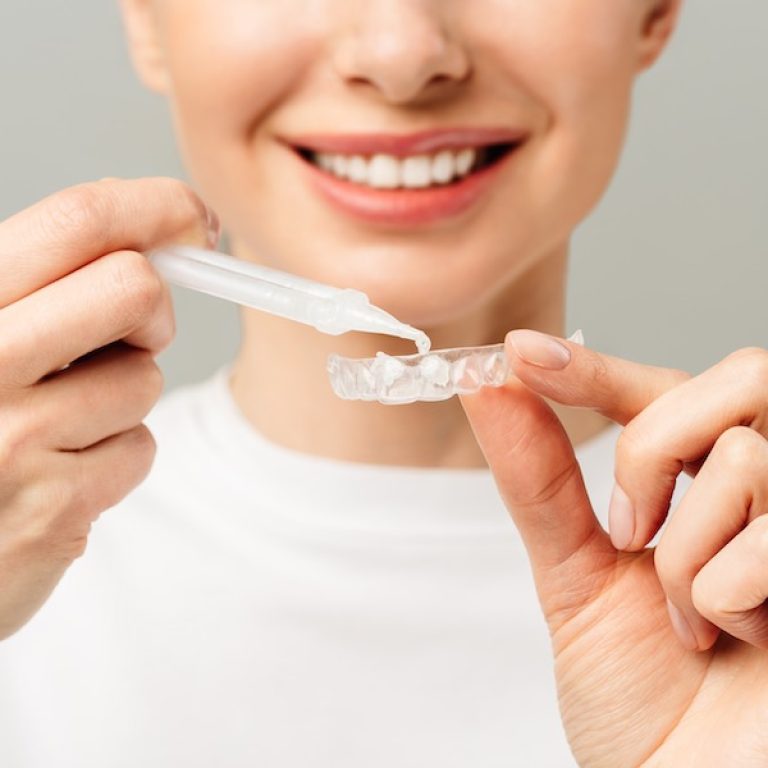 Whitening Trays